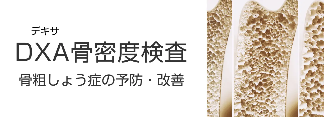 DXA(デキサ)骨密度検査